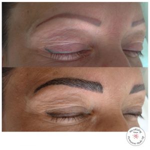 Microblading